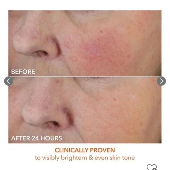 Dr Dennis Gross Vitamin C Lactic Dewy Deep Cream